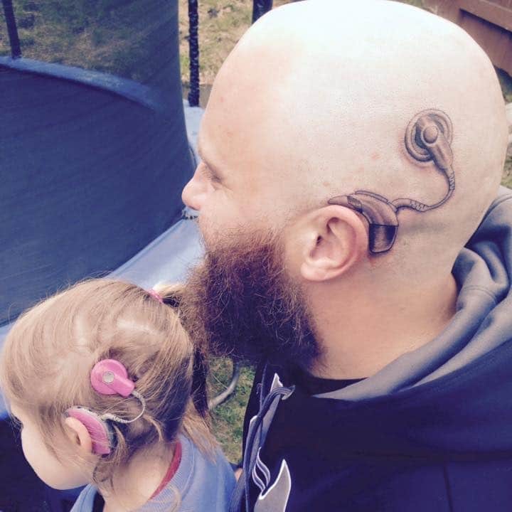 tilestwra.com | Πατέρας έκανε τατουάζ το κοχλιακό εμφύτευμα της κόρης του για να δείξει την υποστήριξή του