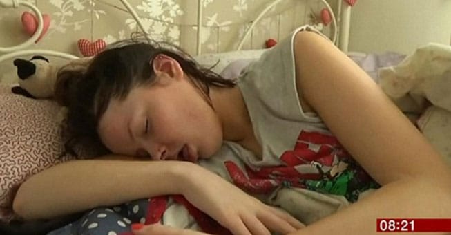 Tι είναι το σύνδρομο της «Ωραίας Κοιμωμένης» που πάσχει 20χρονη;