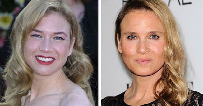 ΣΟΚ! Οι πλαστικές επεμβάσεις έκαναν την Renee Zellweger κυριολεκτικά αγνώριστη!