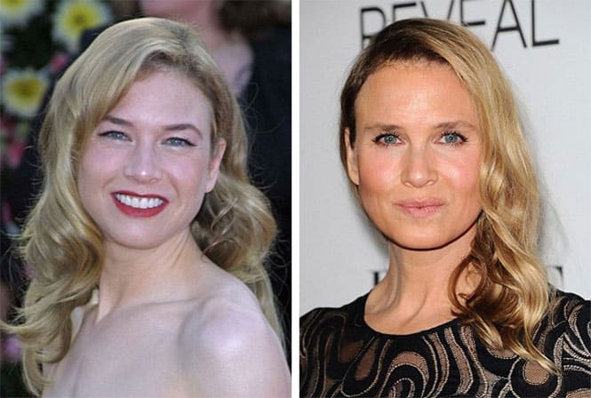 Οι πλαστικές επεμβάσεις έκαναν την Renee Zellweger κυριολεκτικά αγνώριστη! (3)