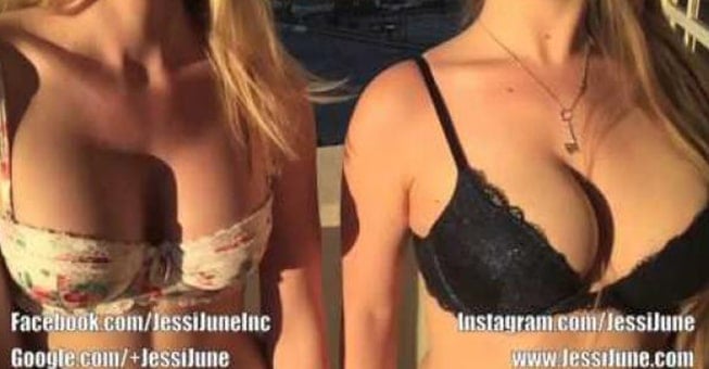Ορίστε πώς θα καταλάβετε αν ένα στήθος είναι ψεύτικο! (βίντεο!)