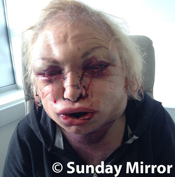 kellie maloney surgery