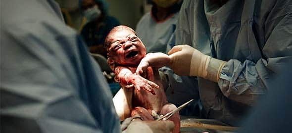 tilestwra.gr : toketos 590 2014 9 8 13 53 42 b Φωτογραφίες τοκετού που αποδεικνύουν περίτρανα το θαύμα της μητρότητας