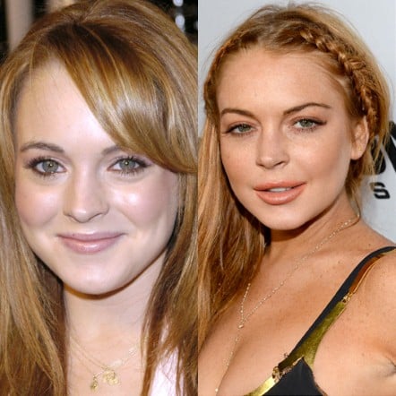 lohan 2543947a