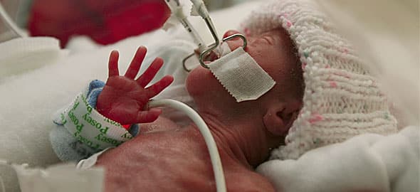 tilestwra.gr : moro prowro 590 b Πρόωρα μωρά: Οι μεγάλοι νικητές της ζωής! Συγκινητικές εικόνες…