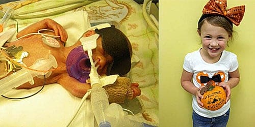tilestwra.gr : proora mora 500 2 Πρόωρα μωρά: Οι μεγάλοι νικητές της ζωής! Συγκινητικές εικόνες…