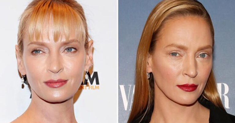 UMA THURMAN: Θα σοκαριστείτε με τη μεταμόρφωση της από τις πλαστικές…