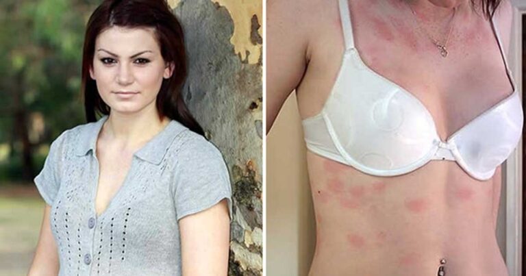 10 περιπτώσεις ανθρώπων με απίστευτα ιατρικά προβλήματα!