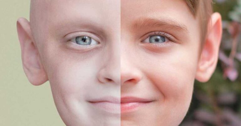 Η ζωή ενός αγοριού με τον καρκίνο και μετά από αυτόν