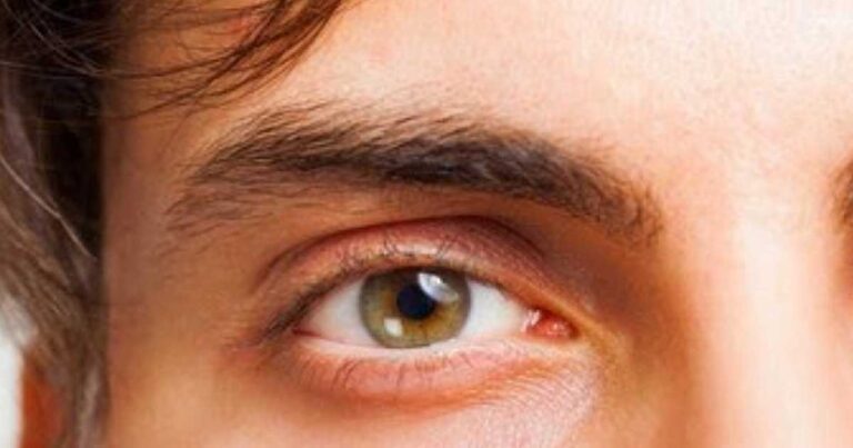 Γιατί βλέπουμε μυγάκια, κηλίδες ή τριχίτσες στα μάτια μας; Πόσο σοβαρό μπορεί να είναι;