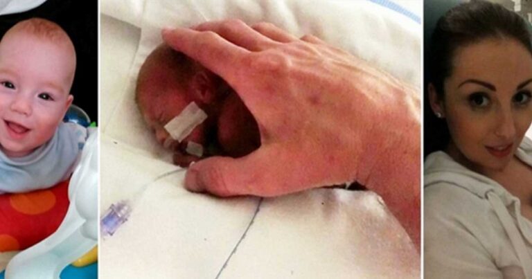 Tο μωράκι με το μέγεθος ίσα με την παλάμη ενός χεριού που κατάφερε να ζήσει! Είχαν πει στη μητέρα να το ρίξει αλλά…