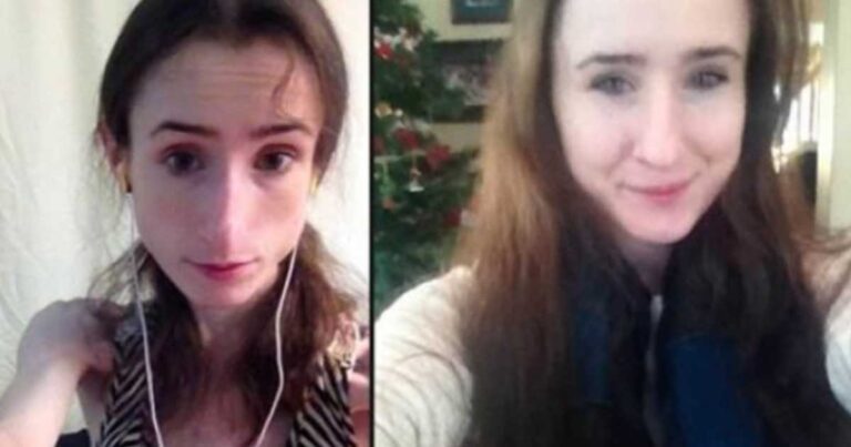 Η 23χρονη κοπέλα που νίκησε την μάχη με την ανορεξία και η ιστορία της σαρώνει στο διαδίκτυο