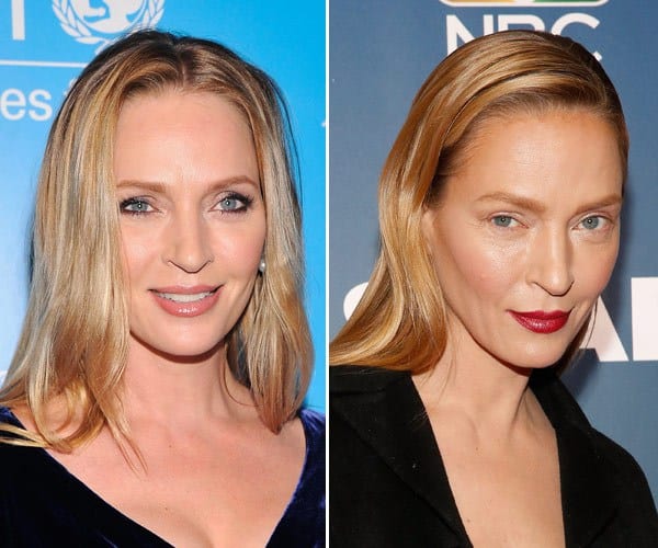 uma-thurman-plastic-surgery-gty-5