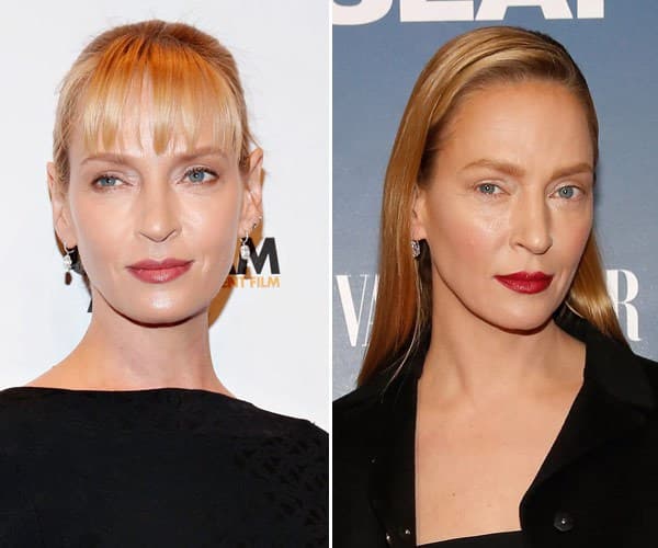 uma-thurman-plastic-surgery-gty-ftr