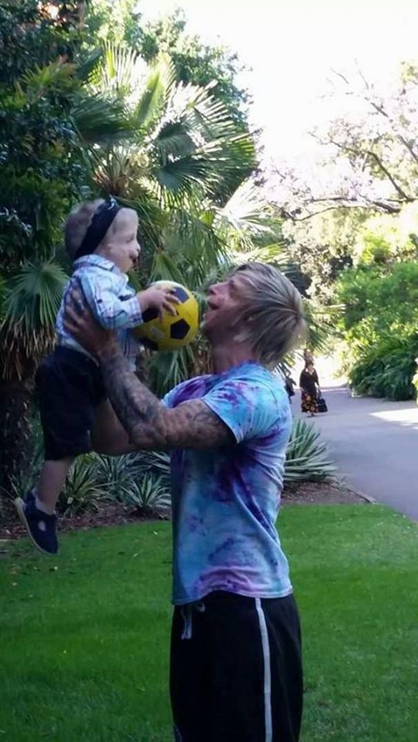 Ένας άντρας με σπάνια πάθηση ταξίδεψε στην Αυστραλία για να βοηθήσει ένα παιδί με την ίδια διαταραχή