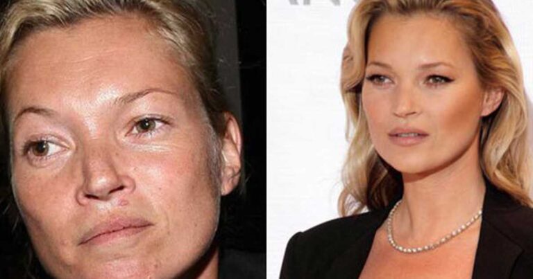 Πως είναι τα πιο ακριβοπληρωμένα μοντέλα χωρίς μακιγιάζ;