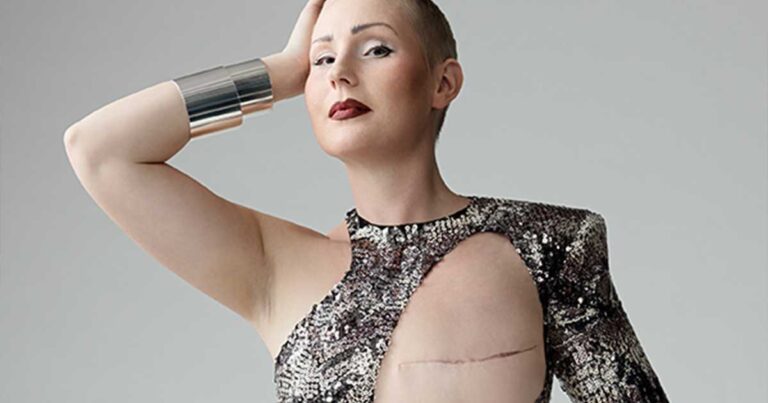 Φωτογραφίες από γυναίκες με μαστεκτομή και μαγιό που παραδίδουν μαθήματα θάρρους!