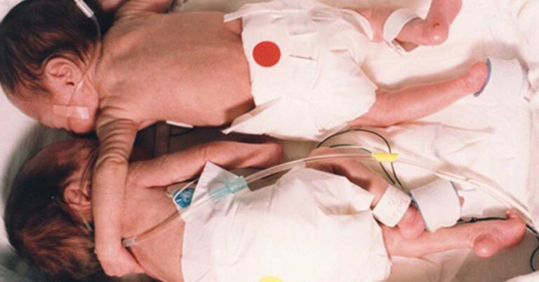 Η δύναμη της αγκαλιάς που της έσωσε τη ζωή!