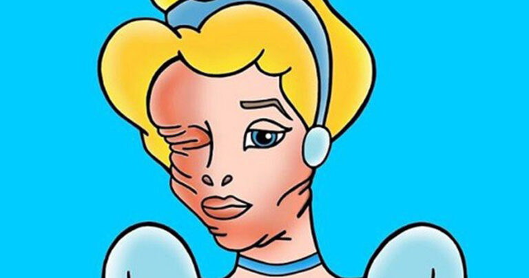 Γιατί οι πριγκίπισσες της Disney δέχτηκαν επίθεση με οξύ;