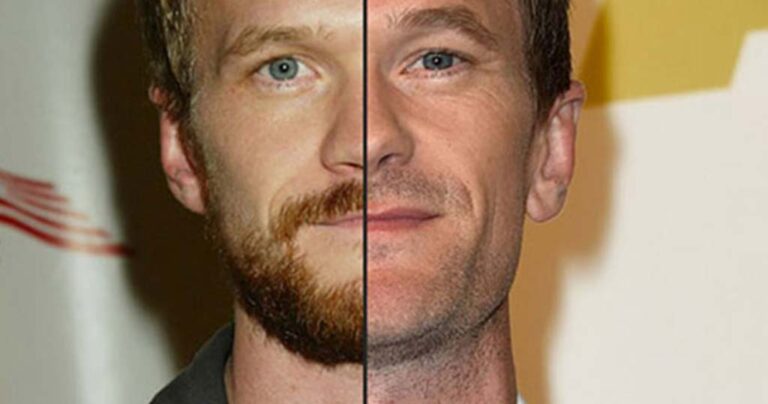 Συγκριτικές φωτογραφίες ότι το μούσι δεν πάει σε όλους τους άντρες