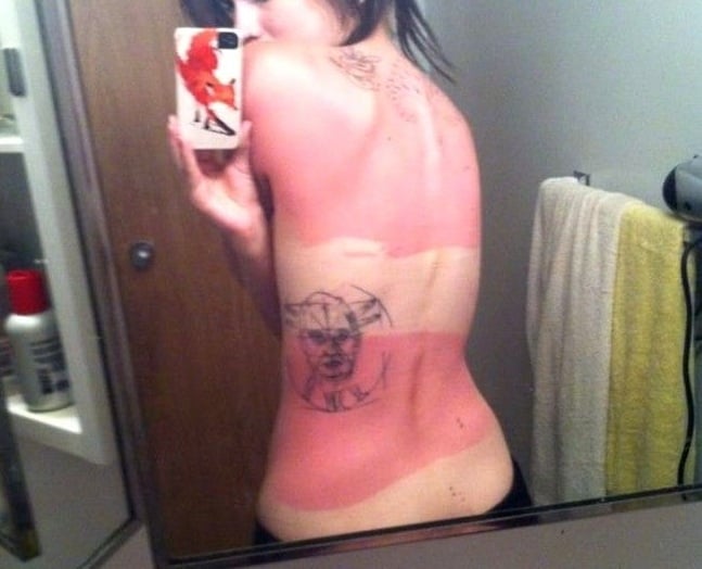 Funny-Sunburn-21