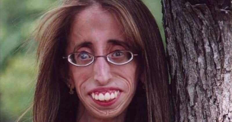 lizzie velasquez