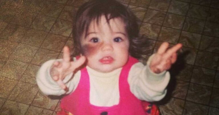 Έπεσε θύμα bullying επειδή είχε αυτό το σημάδι στο πρόσωπο. Η απάντησή της; Πρέπει να την διαβάσετε!