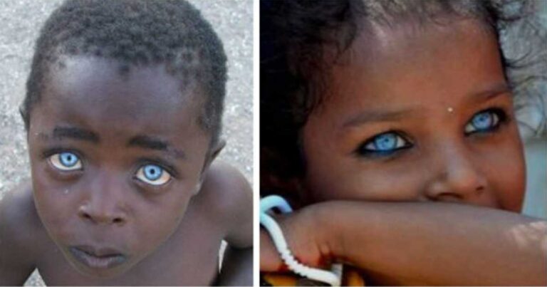 17 φυσιολογικοί άνθρωποι με πανέμορφα μάτια