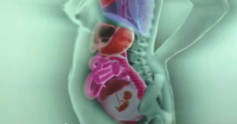 Πως μετακινούνται τα εσωτερικά όργανα μιας γυναίκας κατά τη διάρκεια της εγκυμοσύνης; Μάθετε στο βίντεο που ακολουθεί.