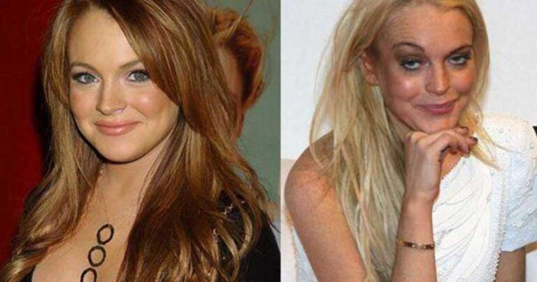 22 διάσημοι που γέρασαν πολύ άσχημα