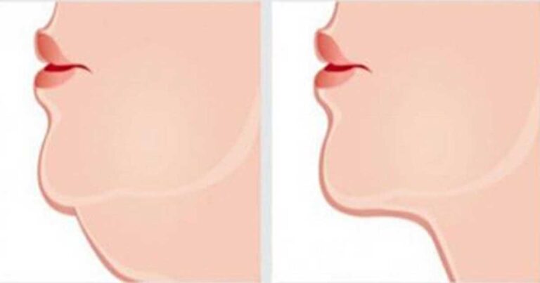 Οι πιο αποτελεσματικές ασκήσεις για να απαλλαγείτε από το διπλοσάγονο