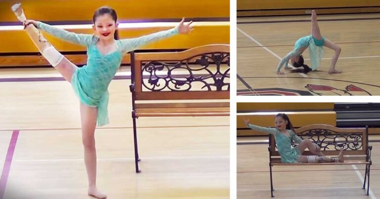 Είπαν σε αυτή την 8χρονη ότι δεν θα μπορέσει να χορέψει ξανά. Εκείνη όμως χόρεψε!