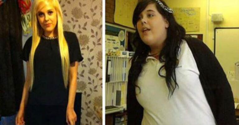 Έχασε 120 κιλά σε 20 μήνες αλλά όχι για το λόγο που νομίζετε