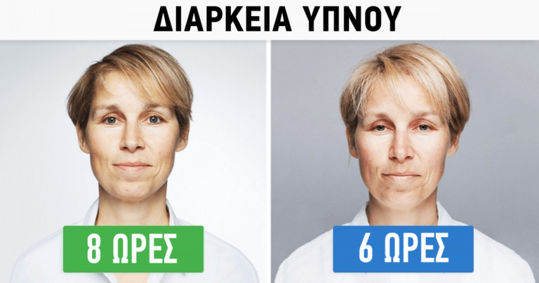 Αυτή η γυναίκα συμφώνησε να κάνει αυτό το πείραμα και τα αποτελέσματα είναι εντυπωσιακά.