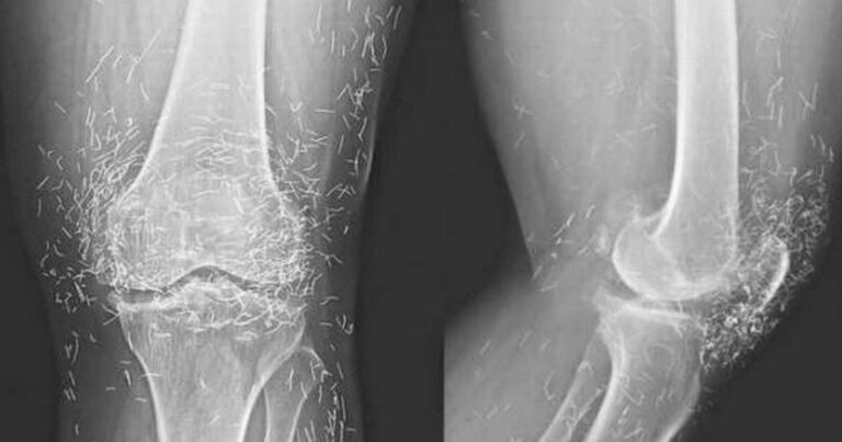 Γιατί οι γιατροί έμειναν έκπληκτοι όταν είδαν αυτή την ακτινογραφία;