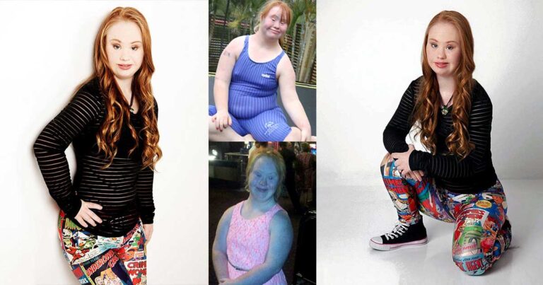 Μοντέλο με σύνδρομο Down: Η 18χρονη από την Αυστραλία που ανατρέπει τα σύγχρονα πρότυπα ομορφιάς!