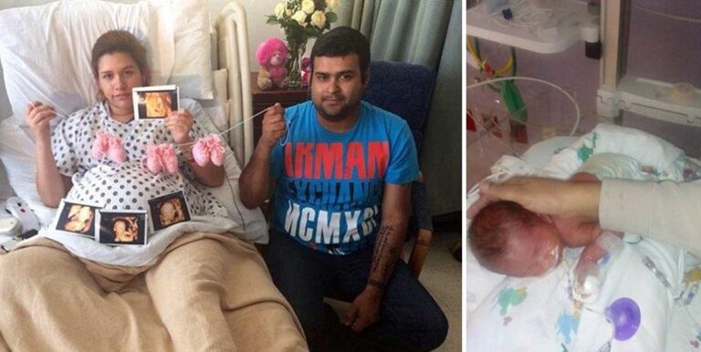 Δυο σώματα, τρία μωρά: Μια σπάνια περίπτωση τριδύμων ήρθε στο κόσμο.