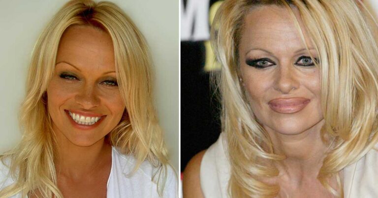 11 διάσημα άτομα που δεν γέρασαν και τόσο… όμορφα