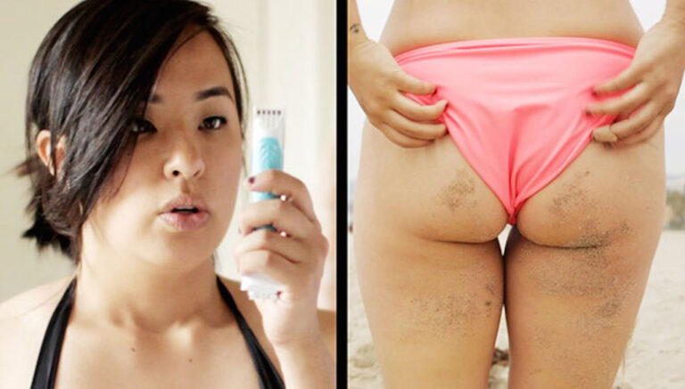 Τα… άσχημα της σεζόν του μπικίνι για τις γυναίκες!