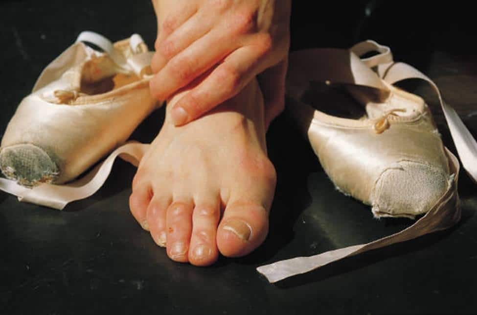 hurt-ballerina-foot