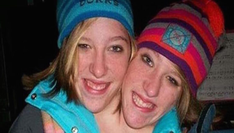 5 γυναίκες που είναι πραγματικά μοναδικές