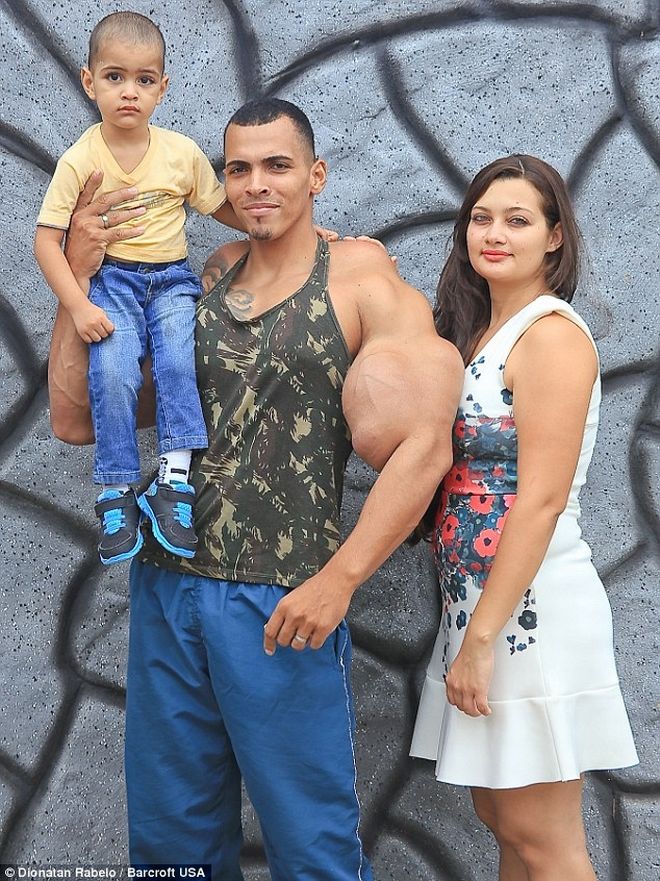 Ο άνθρωπος που έχει στόχο ζωής να γίνει ο Hulk! Φούσκωσε τους μυς του, με ένα "θανατηφόρο κοκτέιλ" 8 realhulk4515sk4