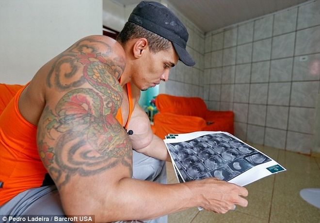 Ο άνθρωπος που έχει στόχο ζωής να γίνει ο Hulk! Φούσκωσε τους μυς του, με ένα "θανατηφόρο κοκτέιλ" 6 realhulk4515sk5