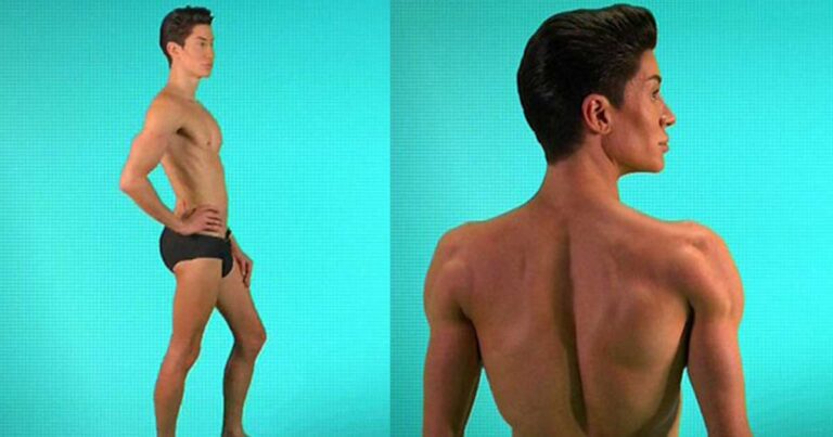 Ο άντρας που έκανε 191 πλαστικές επεμβάσεις για να μοιάσει στον Κεν της Barbie!