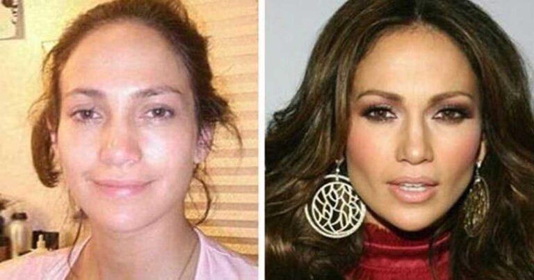 Πριν και μετά: Οι πιο πετυχημένες πλαστικές επεμβάσεις διάσημων γυναικών