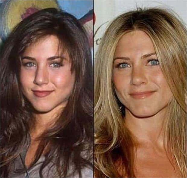 21519789_celebrities_before_and_after06.limghandler