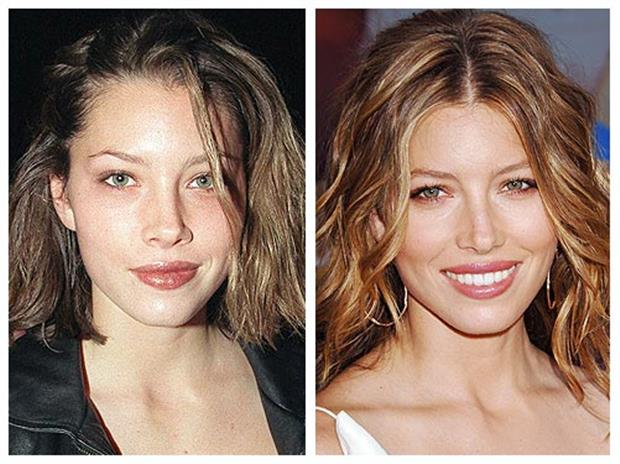 21519793_jessica_biel_plastic_surgery_2.limghandler