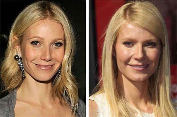 21519794_gwyneth_paltrow_botox_before_and_after.limghandler