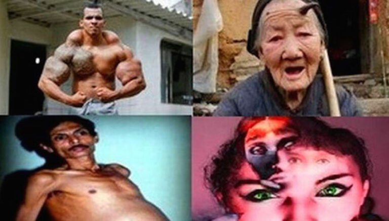 25 περίεργοι άνθρωποι που ζουν ανάμεσά μας! Το 25 θα σας αφήσει άφωνους!