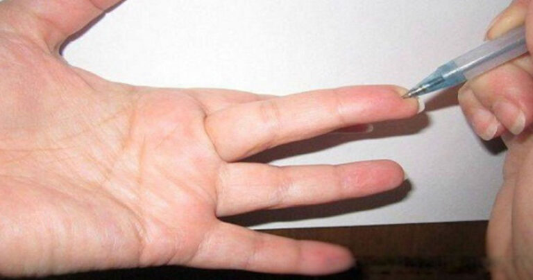 To σημείο στο δάχτυλο που μειώνει την πίεση και εξαφανίζει κάθε είδους πόνο!